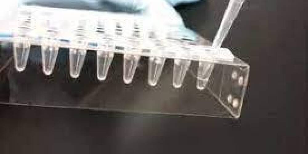 Xét nghiệm Mycoplasma Trong Sản Xuất Tế Bào
