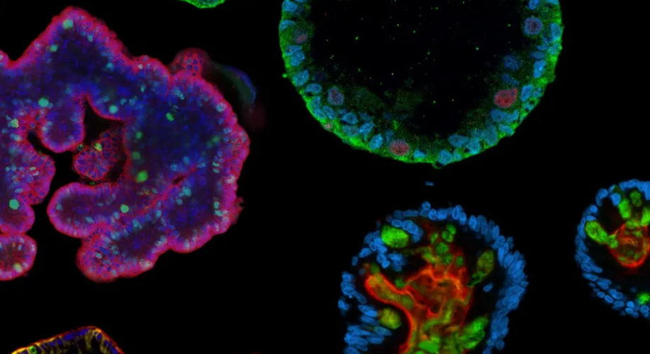 Ngày Hội Organoid Đã Trở Lại!