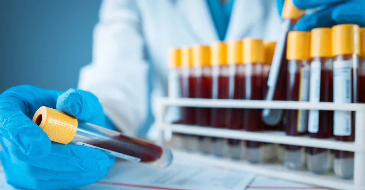 Unveiling the Secrets of PBMC Isolation Tubes: Clinching Clinical Trial Success with the Right Tools