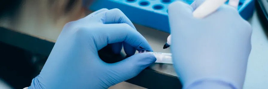 Pluripotent Stem Cell Banking