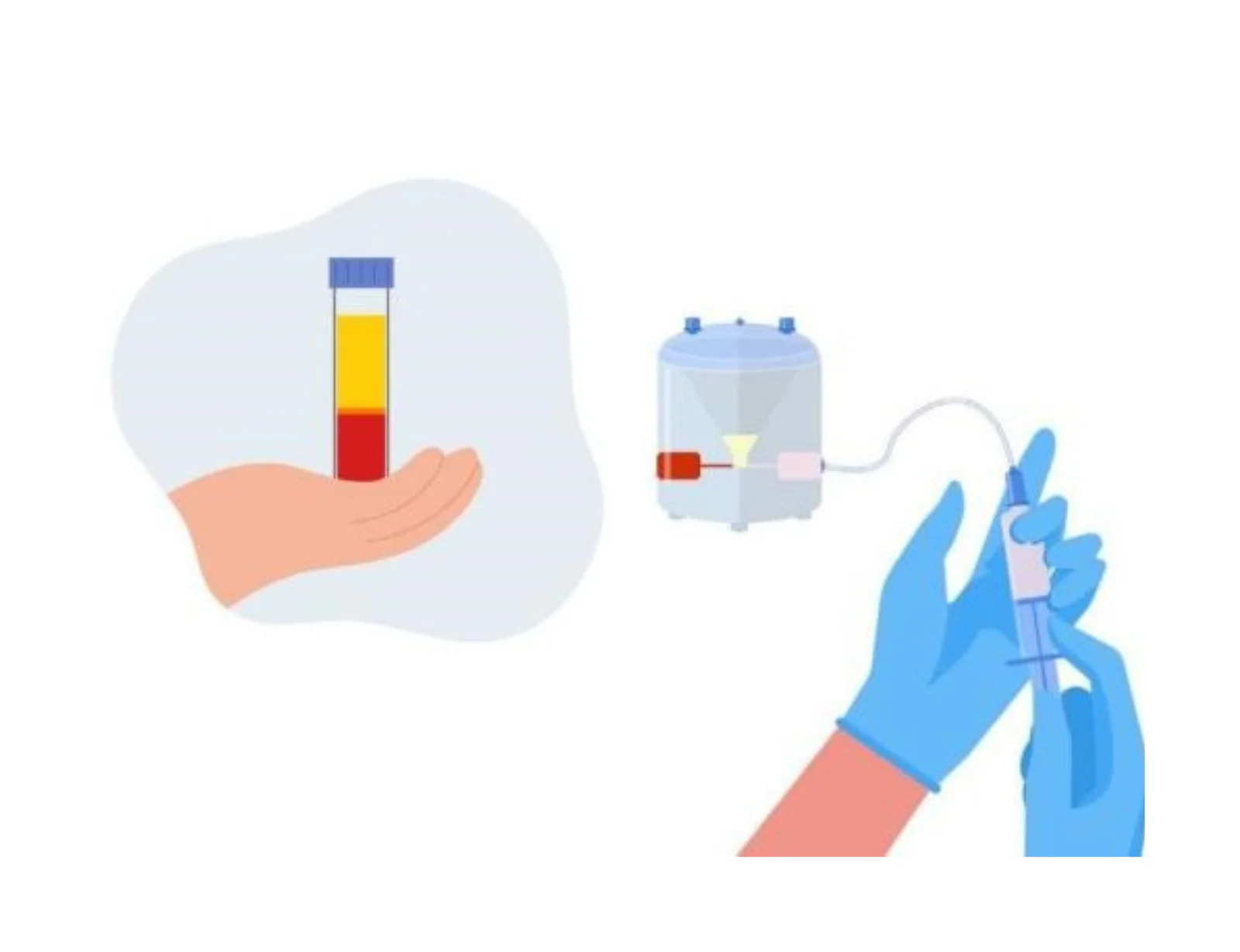 Cell Enrichment Methodologies Using Cord Blood as a Source: Automated vs Manual