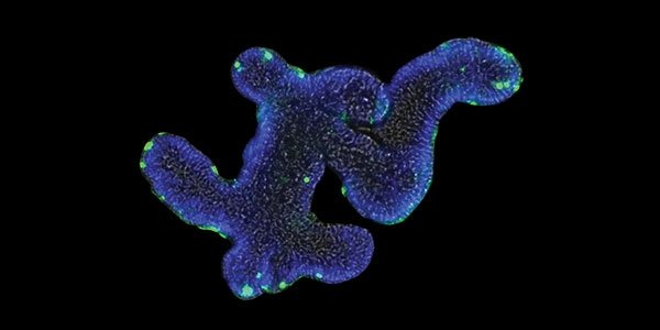 Tools and Technologies for Organoid Culture