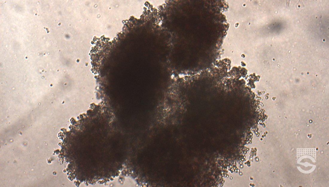 Frequently asked questions about performing a cell cluster culture (CFU Assay)