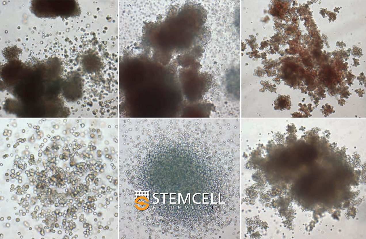 Hematopoietic stem cell discovery: unveiling the historical and future perspective of colony-forming units assay