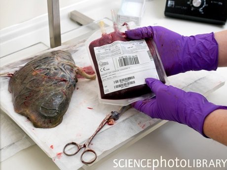 Application of Stem Cells in Medicine