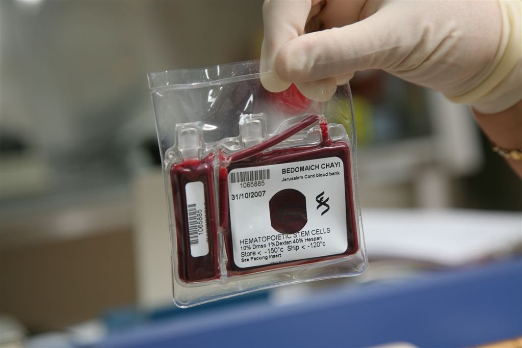 Need To Understand The Purpose Of Umbilical Stem Blood Storage At Stem Cell Banks
