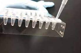 Mycoplasma testing for cell product release