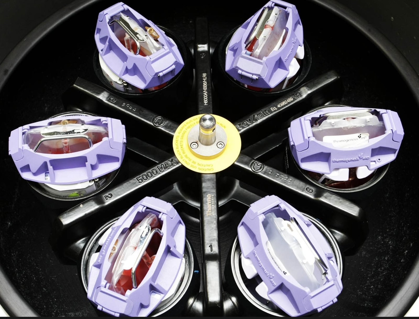 Automated Cord Blood Stemcell Processing using AXP System From Thermogenesis (USA)
