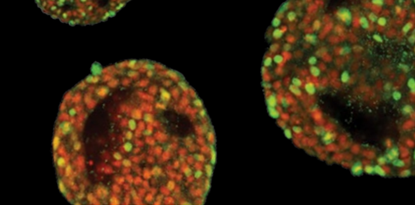 Robust Scale-Up hPSC Using 3D TeSRTM Media And PBS-Mini Bioreactor