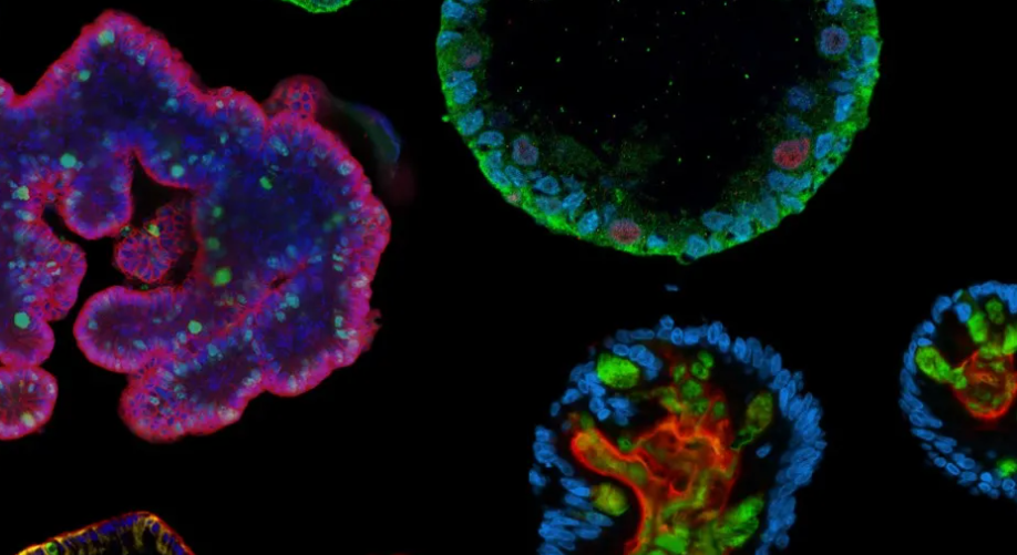 Organoid Day Is Back!