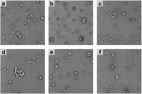 Exosomes có hình dáng điển hình là hình cốc (cup-shaped) với cấu trúc màng phospholipid kép khi được chụp bởi TEM