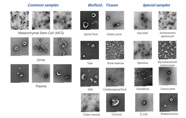 Hệ thống EXODUS cho phép phân lập EVs từ nhiều loại mẫu dịch sinh học và nhiều thể tích mẫu khác nhau