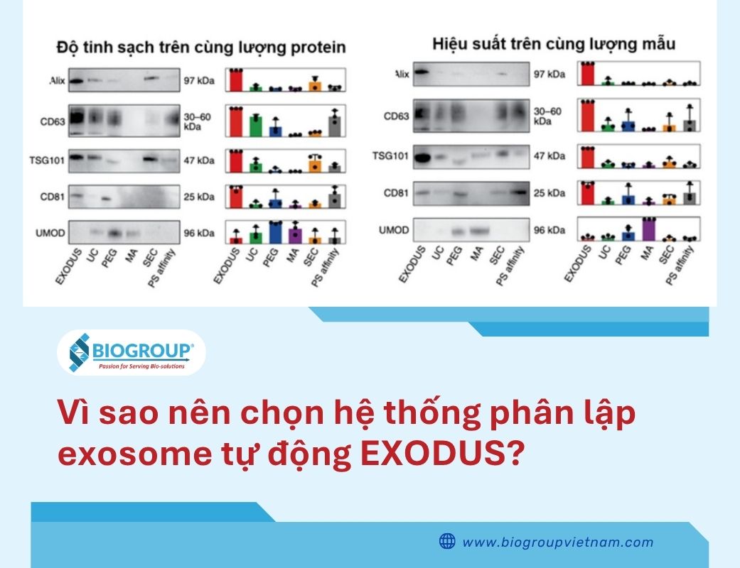 Vì sao nên chọn hệ thống phân lập exosome tự động?